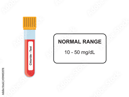 Serum Potassium Blood Test Concept Design. Vector Illustration.