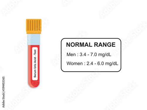 Serum Uric Acid Blood Test Concept Design. Vector Illustration.