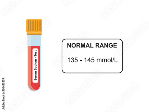 Serum Sodium Blood Test Concept Design. Vector Illustration.