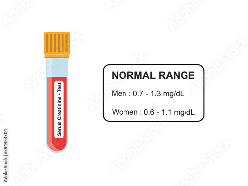 Serum Creatinine Blood Test Concept Design. Vector Illustration.