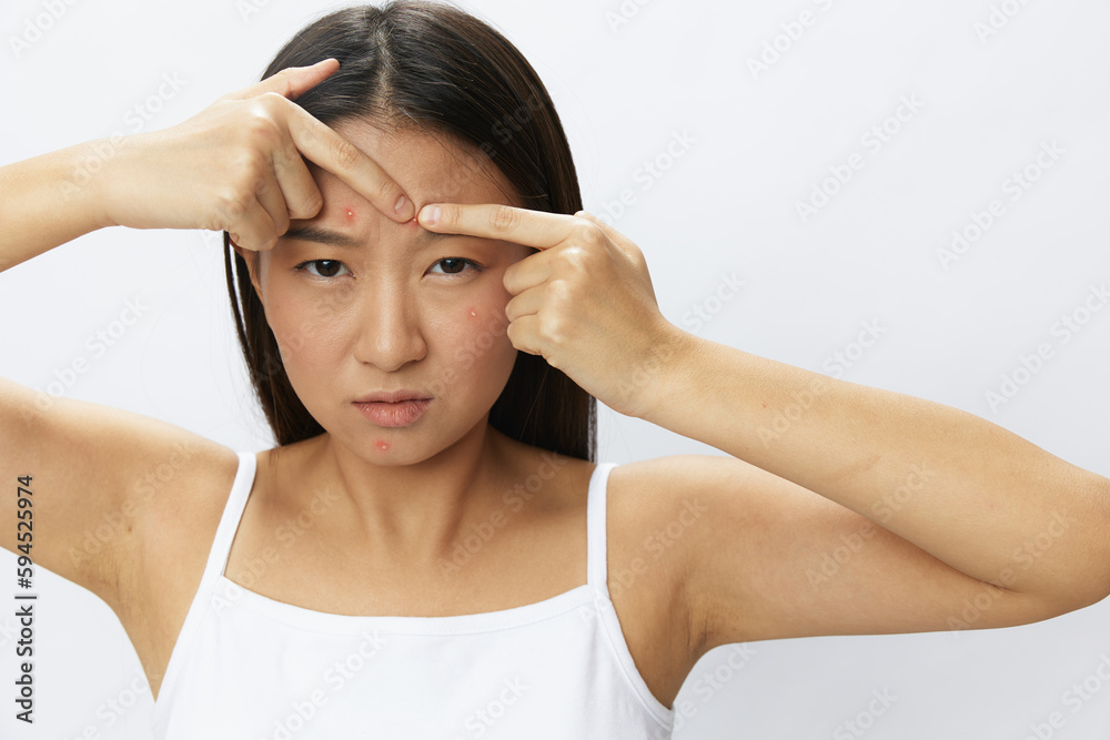 Asian woman facial skin problems, acne and inflammation, red rashes and allergies, chicken pox, sadness from rashes. Facial skin care concept for diseases and nerves Asian woman facial skin problems, acne and inflammation, red rashes and allergies, chicken pox, sadness from rashes. Facial skin care concept for diseases and nerves