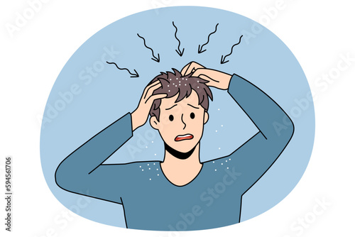 Itchy head and dandruff concept. Stressed irritated man standing and having itchy scalp feeling problems with health and scratching hair vector illustration