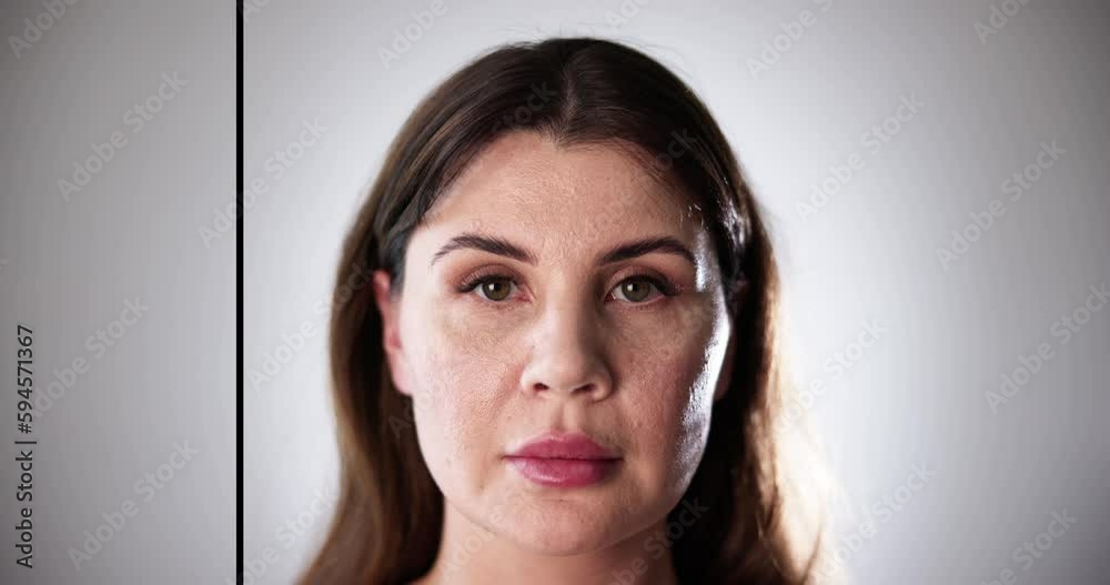 Before After Young Girl Face Wrinkle Before After Young Girl Face Wrinkle