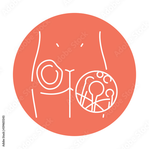 Cutaneous mucormycosis color line icon. Human diseases.