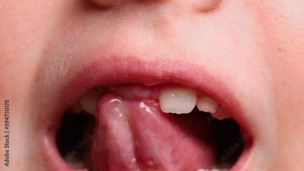 Close up unrecognizable little child toothless mouth showing teeth and