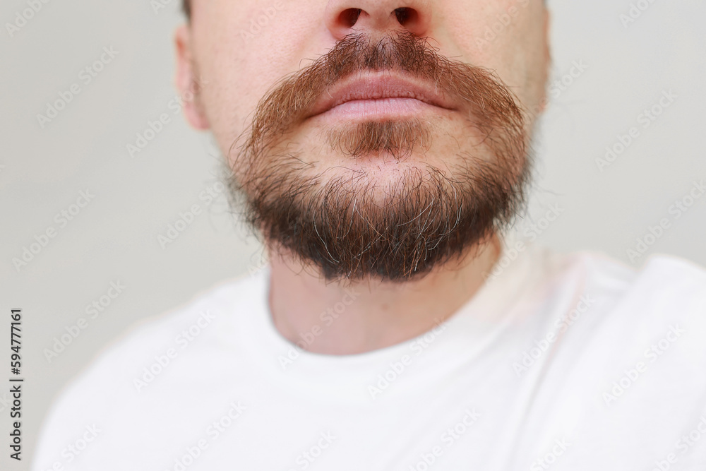 Fototapeta premium Cropped photo of bearded man first gray hairs on overgrown shaggy beard and moustahe. Loss of melanin at young age, causes-genetic predisposition, hormonal, disorders of the endocrine system