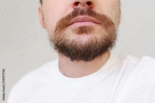 Cropped photo of bearded man first gray hairs on overgrown shaggy beard and moustahe. Loss of melanin at young age, causes-genetic predisposition, hormonal, disorders of the endocrine system