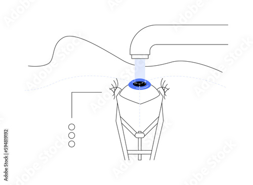 Cataract surgery procedure abstract concept vector illustration.