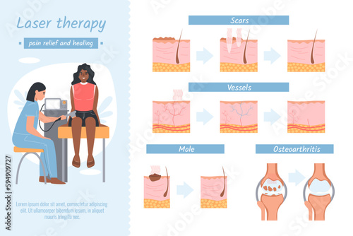 Laser Therapy Relief Infographics