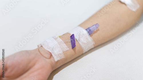 Arm puncture for intravenous infusion or medication for hospitalized patients  Treatment of patients with intravenous injections to allow the patient to receive the drug directly.