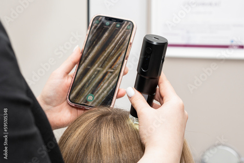 Consultation with a trichologist. The doctor examines a macro video from a trichoscope on the screen of a mobile phone. examination of the scalp and hair follicles of a caucasian female patien photo