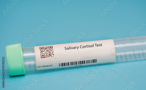 Salivary Cortisol Test