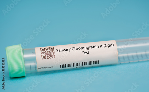 Salivary Chromogranin A (CgA) Test