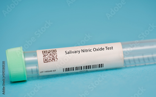 Salivary Nitric Oxide Test
