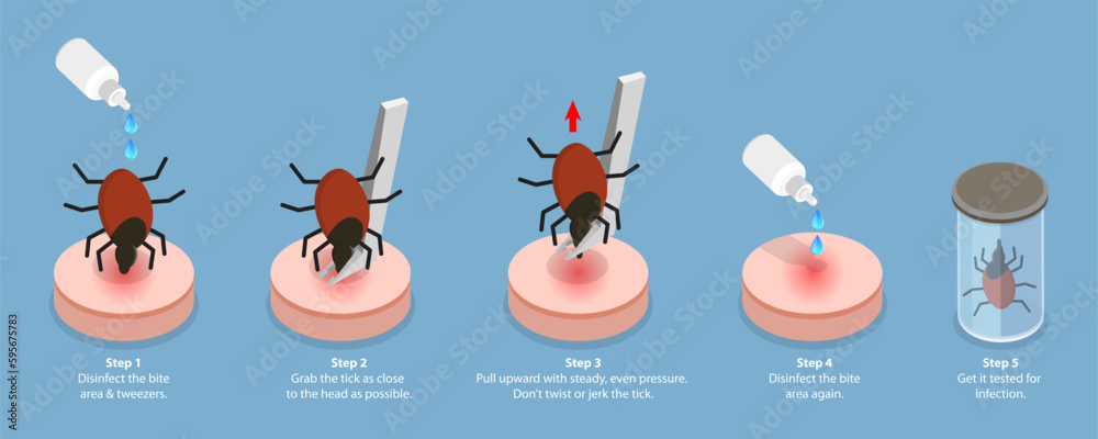 3D Isometric Flat Vector Conceptual Illustration of How To Remove a Tick, A Parasite Carrying a Disease