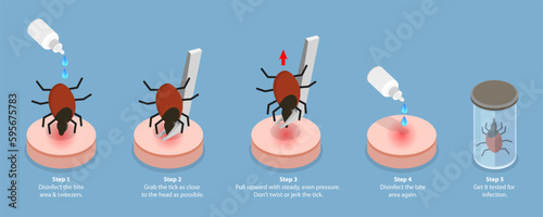 3D Isometric Flat Vector Conceptual Illustration of How To Remove a Tick, A Parasite Carrying a Disease