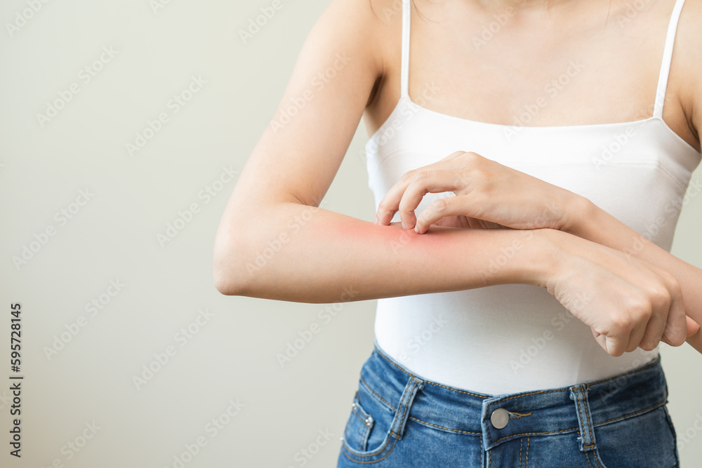 Dermatology, asian young woman reaction from atopic, insect bites on ...