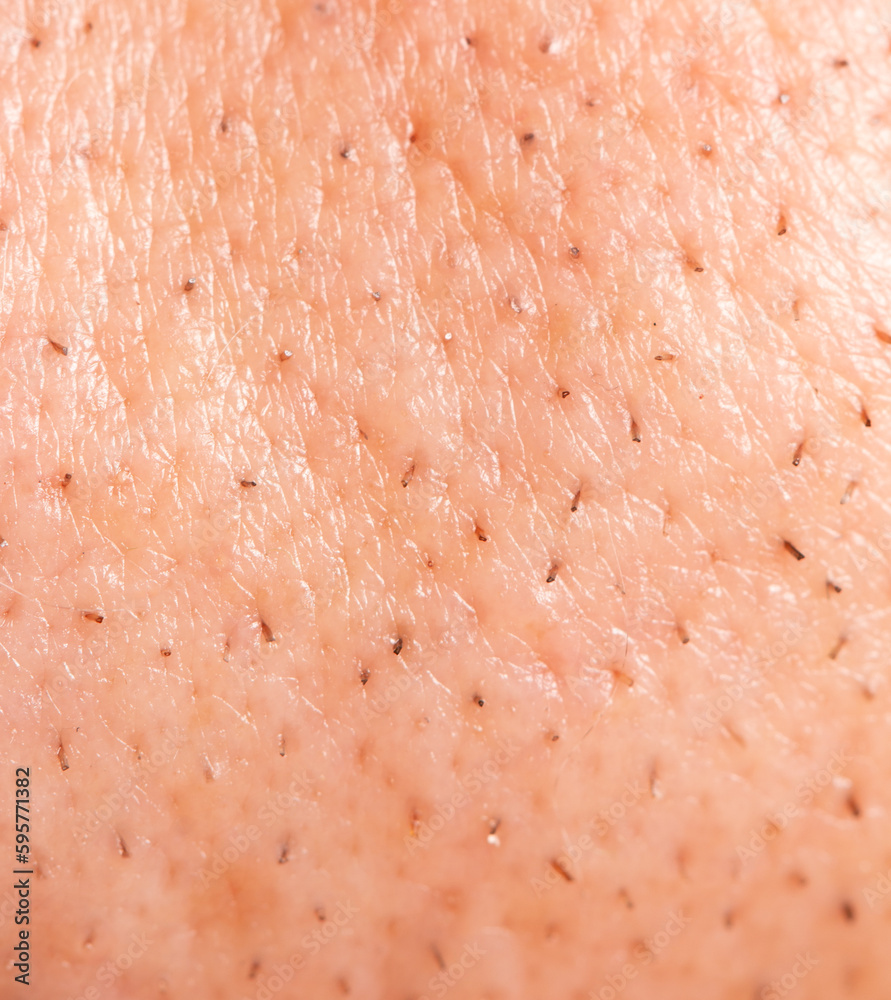 Small hairs on the skin of a man's face. Macro.