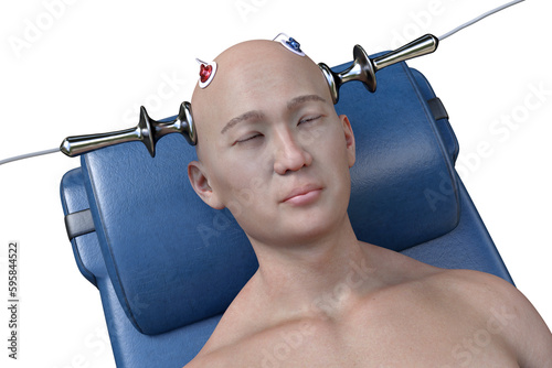 Electroconvulsive therapy, ECT, a treatment involving the use of electrical currents to stimulate the brain, 3D illustration photo