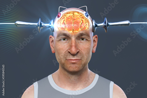 Electroconvulsive therapy, ECT, a treatment involving the use of electrical currents to stimulate the brain, 3D illustration photo