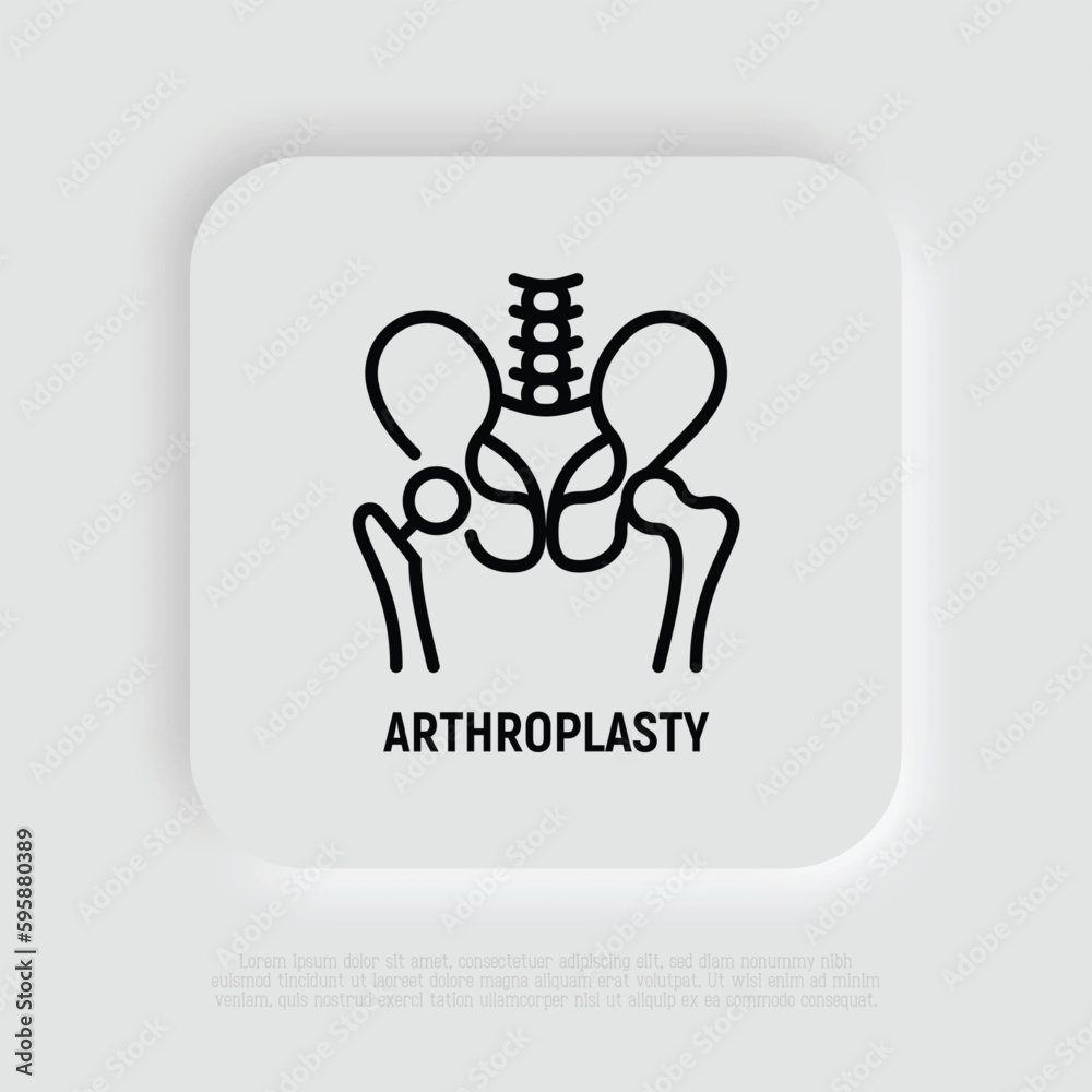 Arthroplasty thin line icon, artificial joint, surgical procedure to restore joint. Arthritis. Vector illustration.