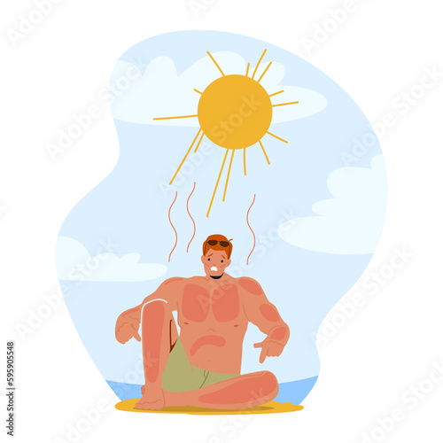 Man Grimacing In Pain From Sunburn On Beach, Red And Inflamed Skin, Seeking Relief And Shade From The Scorching Sun