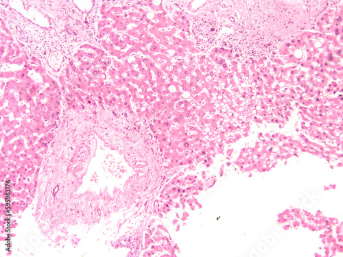 picture of histology human tissue with a microscope from the laboratory  not Illustration Designation 