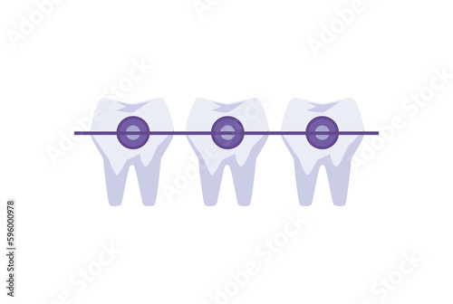 Teeth with metal braces flat style, vector illustration