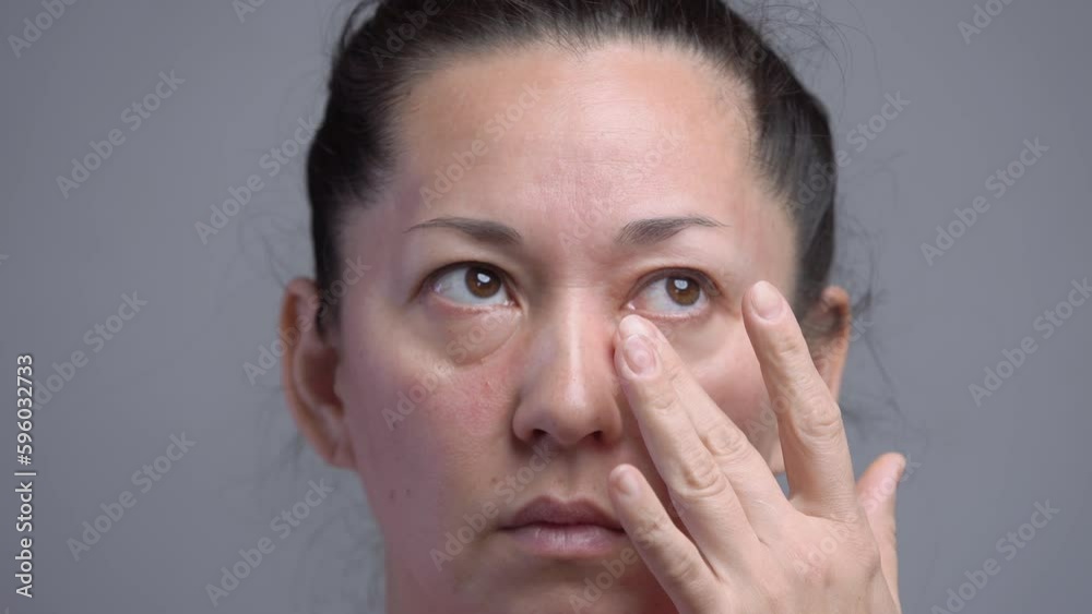 Allergic face. Allergy on the face of a woman Allergic face. Allergy on the face of a woman