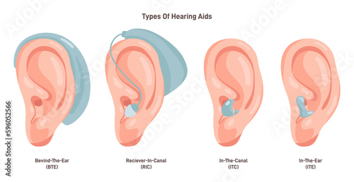 Hearing aids types set. Neuroprosthesis to a deaf person. Hearing loss