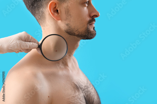 Dermatologist examining mol...