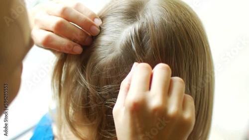 Mom destroys lice on her daughter's head photo