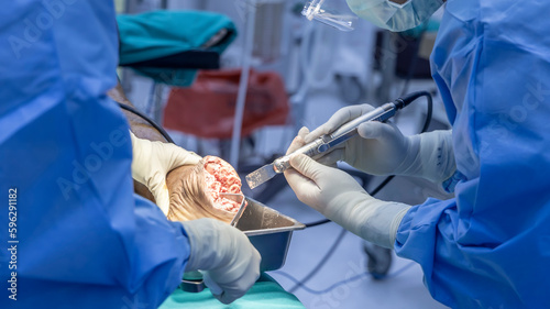 Foto Doctor or surgeon in blue uniform using surgical saw inside modern operating room in hospital