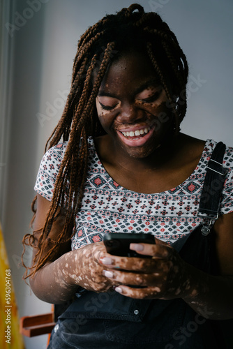 Girl with vitiligo in her painting studio laughing after reading a message on her mobile phone
