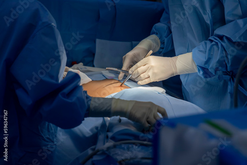 Doctor or surgeon in blue surgical gown did surgery inside operating room in hospital.People did sensory testing after general anesthesia in patient undergo abdominal surgery.Spinal anesthetic block.