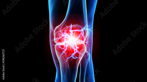 3d rendered medical illustration of the anterior skeletal knee