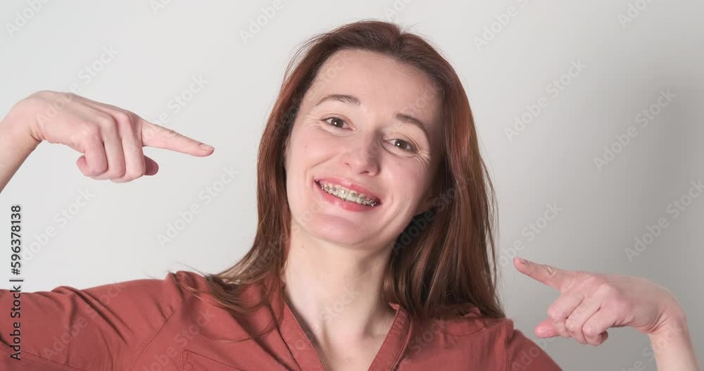 Woman with braces smiling and pointing at herself. Dentistry concept, teeth alignment, orthodontist, happy patient. Woman with braces smiling and pointing at herself. Dentistry concept, teeth alignment, orthodontist, happy patient.