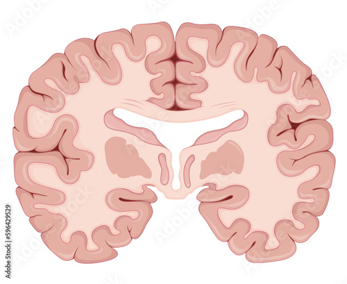 Brain Transverse Section - Illustration photo