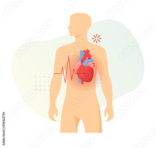 Heart Attack Symptoms - Stock Icon