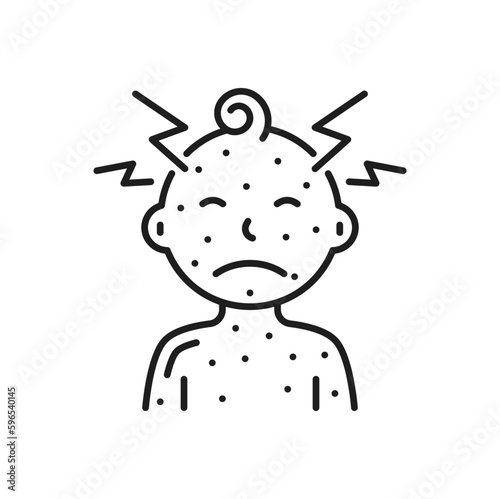 Baby boy with chickenpox and head ache, skin rash, hives, irritation measles. Vector food, medication allergic reaction, skin disease, itching rashes