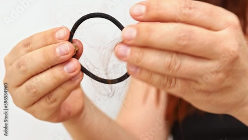 Women's hands in front of camera remove lot of fallen hair from elastic band. Alopecia. Close-up. Lack of trace elements. Hair treatment. Stress and illness. Aggressive environment. 4k footage.