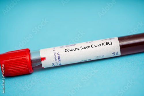 Complete Blood Count (CBC)