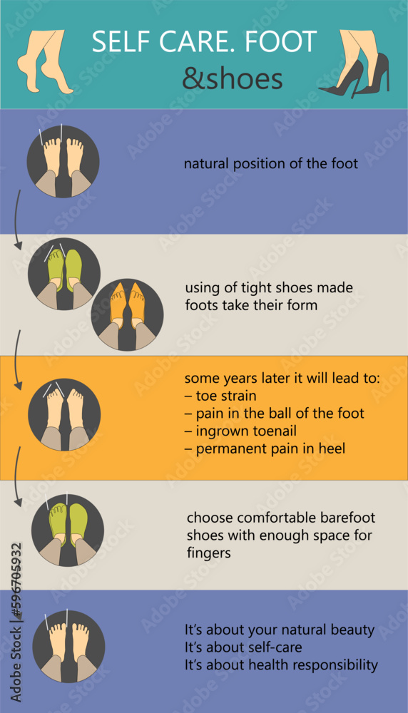 Self care foot deformity and barefoot shoes Infographics - obrazy, fototapety, plakaty 