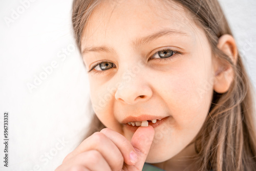 Charming smiling little girl kid with opened mouth shows staggering loose falling out first baby milk front tooth. Preschooler teeth changing. Healthy dental hygiene. Lost tooth. Dentist treatment