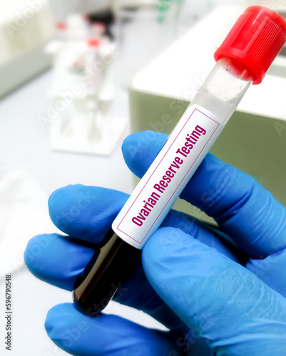 Doctor Holding a blood sample for Ovarian Reserve Test, ORT is a test combination of FSH Estradiol, AMH (Anti-mullerian hormone). photo