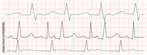 Set of black heartbeat diagrams on red graph paper. ECG electrocardiogram chart. Cardiac rhythm line. Cardio test signs. Vector graphic illustration