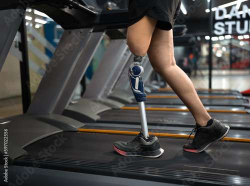 Low angle view woman with prosthetic leg walking in treadmill at fitness gym