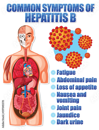 Informative poster of common symptoms Hepatitis B
