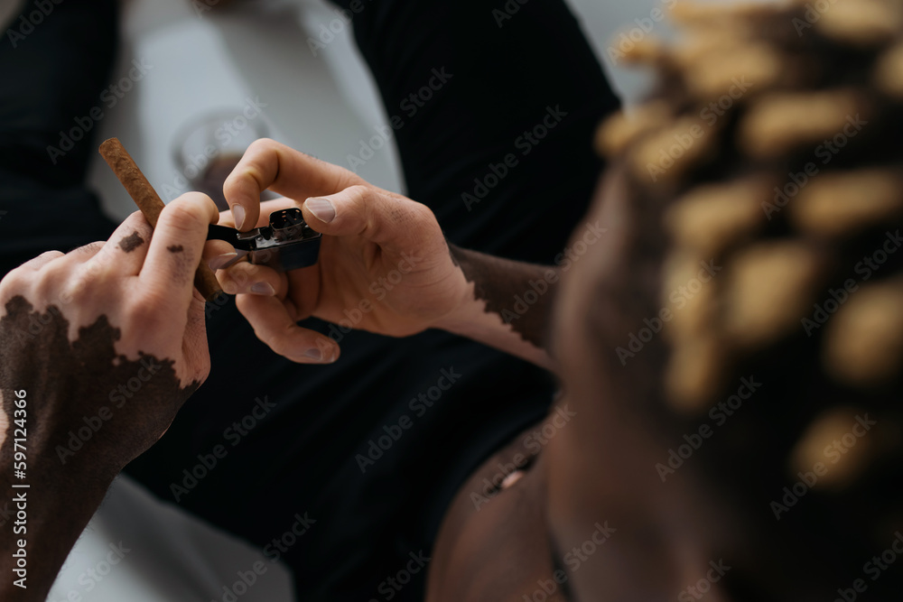 Overhead view of african american man with vitiligo holding lighter and cigar in bathroom.