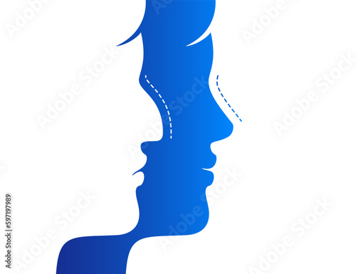 Woman with crooked and straight nose and different emotions. Nose rhinoplasty effect before and after correction, medical vector illustration isolated on a white background.